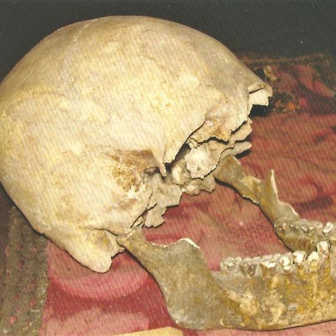 Un cranio misterioso, potrebbe essere di Plinio