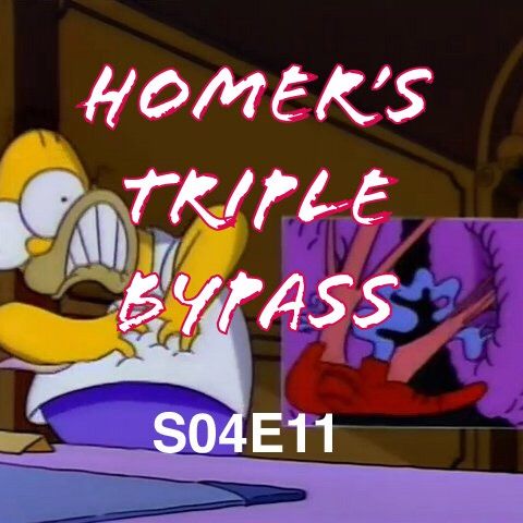 35) S04E11 (Homer's Triple Bypass)