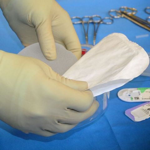 Dottor Quatela, chirurgo plastico: «Il botox non gonfia!»