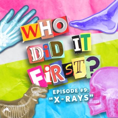 X Rays - Episode 9 - Who Did It First?