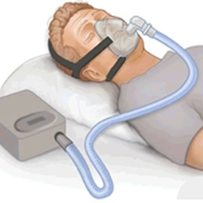 #4: Sleep Apnea Treatment Options