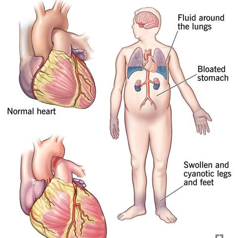 29 - CHF Pharm And Interventions