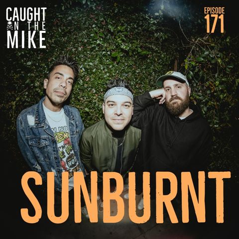 SUNBURNT