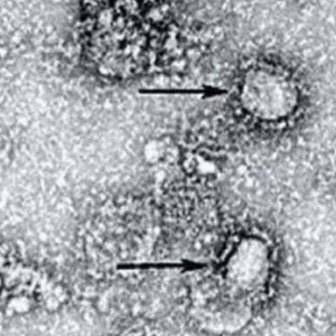 EUA registran más de 60 mil casos de coronavirus