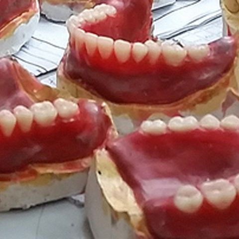 Situación de las prótesis dentales en Ciego de Ávila