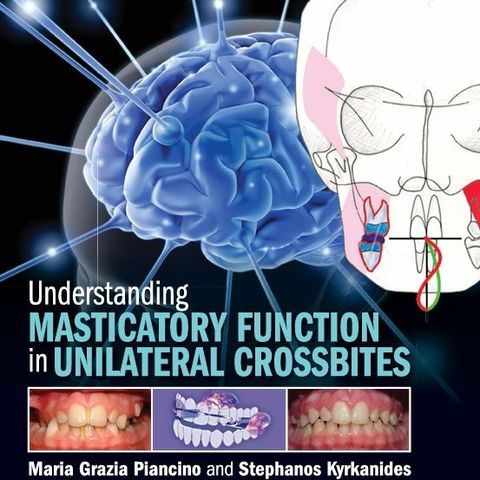 Understanding Masticatory Function in Unilateral Crossbites