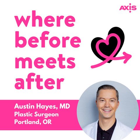 Getting longer lasting internal bra breast lift results without absorbable mesh [Austin Hayes, MD, Portland]