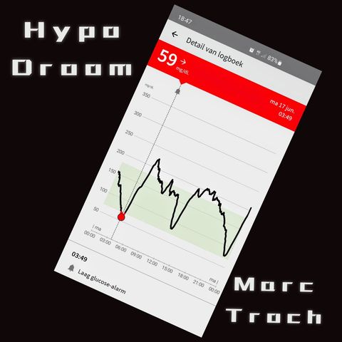 HypoDroom - Marc Troch