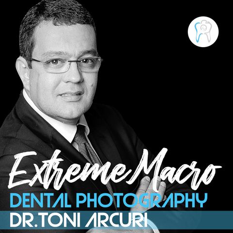 Extreme Macro in Dental Photography with Dr Toni Arcuri, Brazil