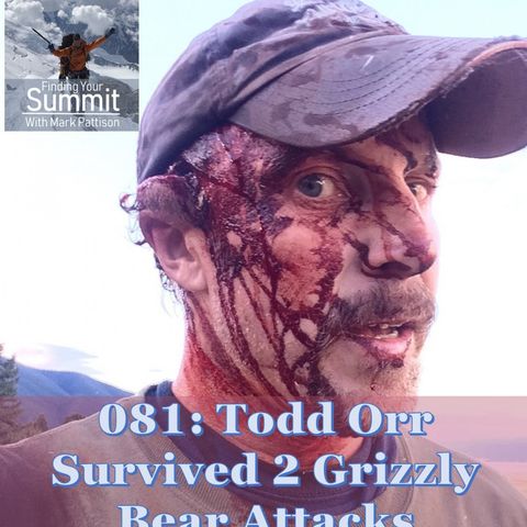 Todd Orr - Survived 2 Grizzly Bear Attacks