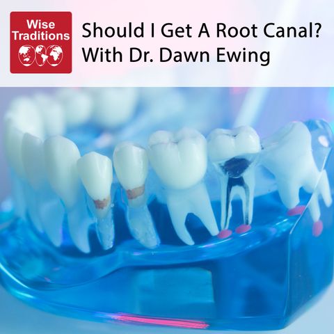 395: Should I Get A Root Canal?