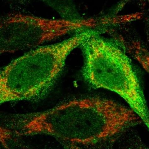 Antioxidants From Mitochondria Protect Cells From Dying [W[R]C]