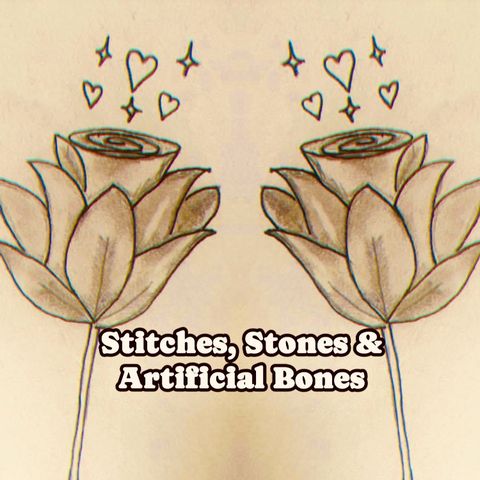 Episode 5 - Stitches, Stones & Artificial Bones