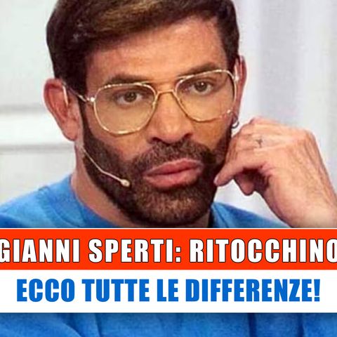 Gianni Sperti Si E' Ritoccato? Ecco Tutte Le Differenze!