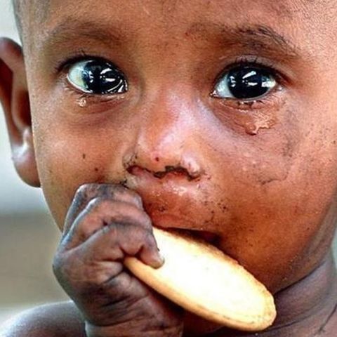Ep 33 | Desnutrición Infantil. La vergüenza y la desidia.