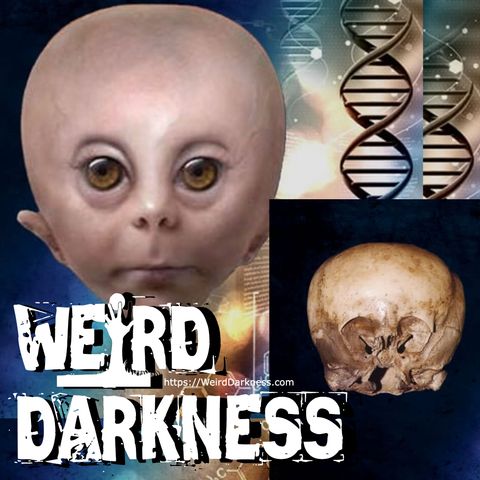 “IS THE STARCHILD AN ALIEN-HUMAN HYBRID?” and More Strange, True Stories! #WeirdDarkness