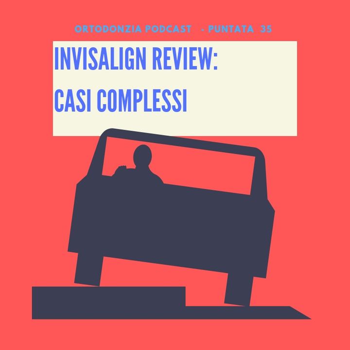 Invisalign review: casi complessi
