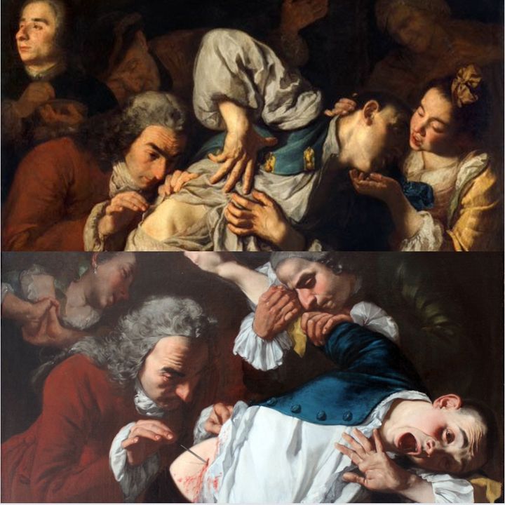 L'arte incontra la Medicina, G.Traversi-L'operazione e la visita, 1752-53