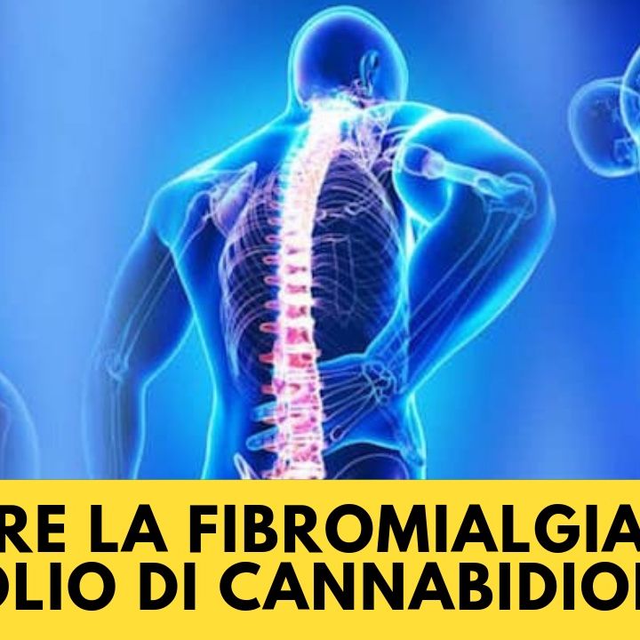 Curare la fibromialgia con l'olio di Cannabidiolo (CBD)