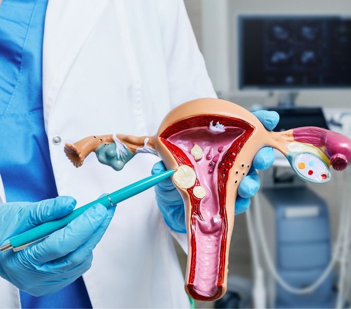 Polipi endometriali: alla San Gaetano Clinica e Ricerca la diagnosi e il trattamento sono in day hospital