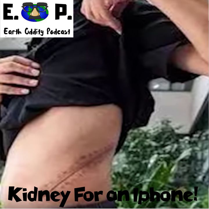Earth Oddity 52: Kidney for an Iphone