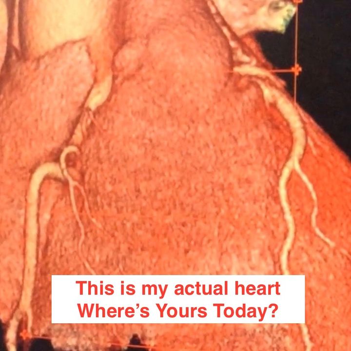 Karel Tues Mar 15 Mo Langan Plus, Where is Your Heart Truly?