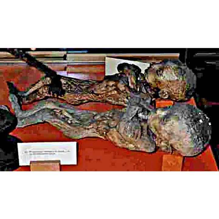 Le mummie della collezione anatomica di Lodi (Lombardia)