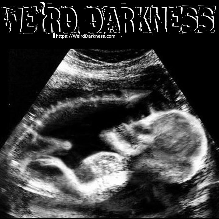 “REAL CASES OF ROSEMARY’S BABY” and More Terrifying True Horror Stories! #WeirdDarkness