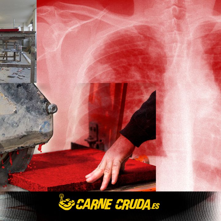 Carne Cruda - Esta encimera cuesta un pulmón (#797)