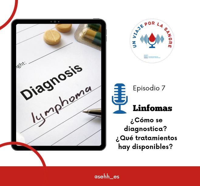 7. Los linfomas