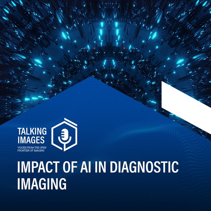 Impact of AI in diagnostic imaging
