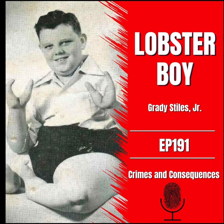 EP191: Lobster Boy