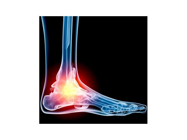 Chronic Foot Pain with Dr. Roy Mathews DPM