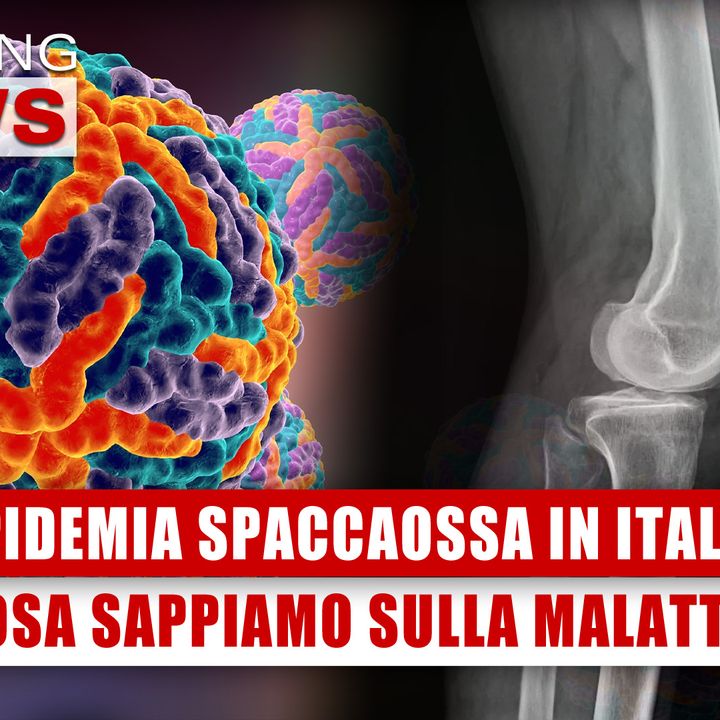 Epidemia Spaccaossa In Italia: Cosa Sappiamo Sulla Malattia! 