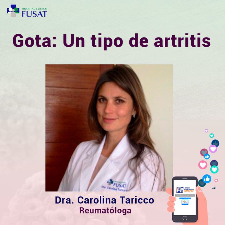 Jueves 24: Dra Carolina Taricco, Reumatóloga - Gota: Un tipo de artritis