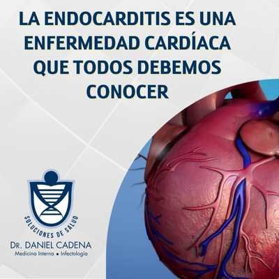 La endocarditis es una enfermedad cardíaca que todos debemos conocer
