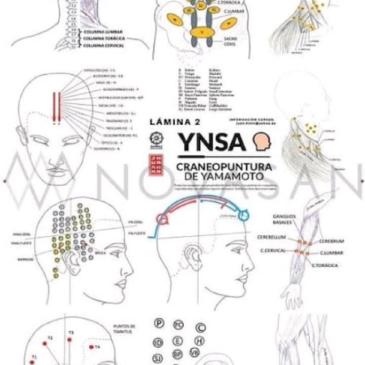 Craniopuntura Oa Joelho