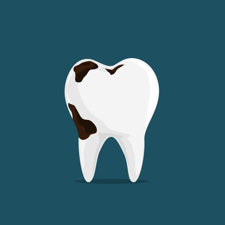Perché i denti si ammalano, e perché li perdiamo? | Ep. 1