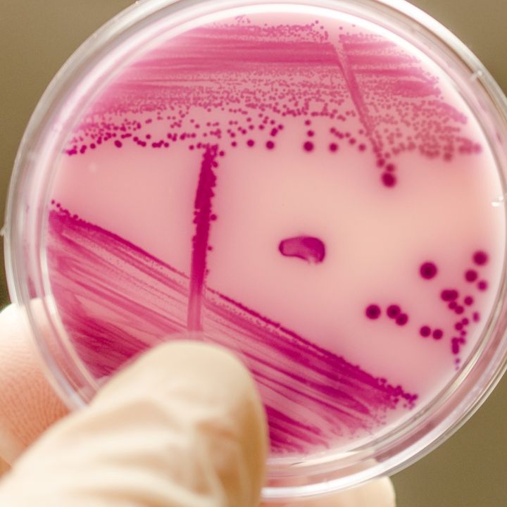 Would you eat meat grown in a lab? Talking farming, as biosecurity intercepts a deadly fungus