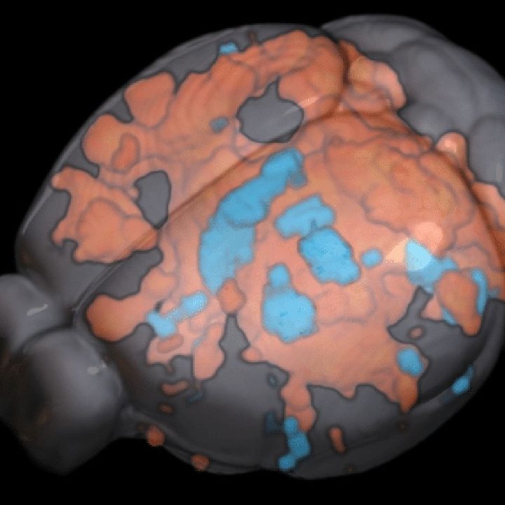 New Technology May Help Inform Brain Stimulation [W[R]C]