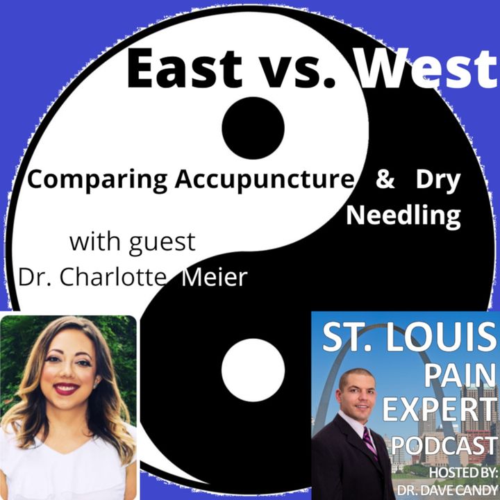 East vs. West - Comparing Acupuncture & Dry Needling with guest Dr. Charlotte Meier
