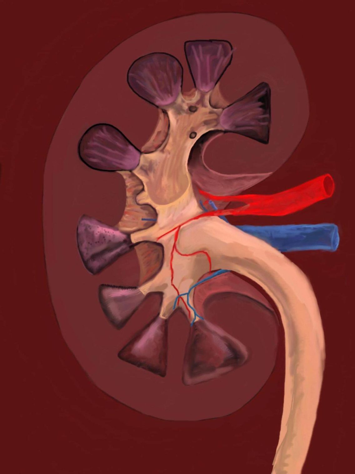 Paciente de hemodiálisis - Cover Image